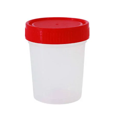 VASO PARA MUESTRA FM+M TAPA ROJA