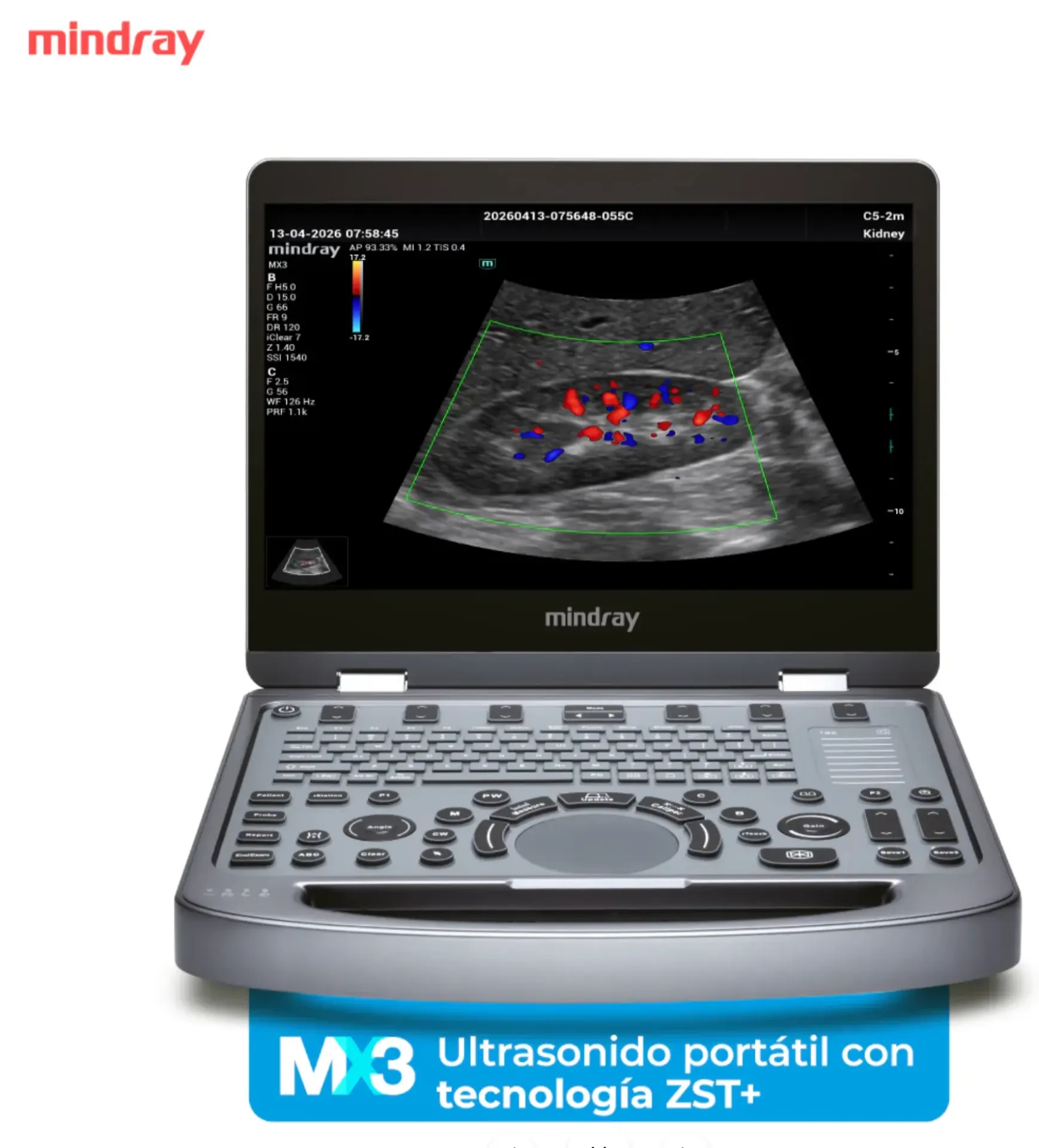 [MX3CL] Sistema de Ultrasonido Portátil MX3, Tecnología ZST+, con Transductores Lineal y Convexo, Marca Mindray